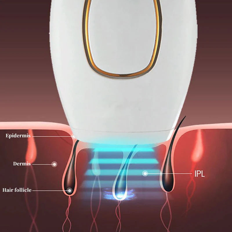 Depiladora Láser Eléctrica Lux® - (Últimas unidades en Stock)